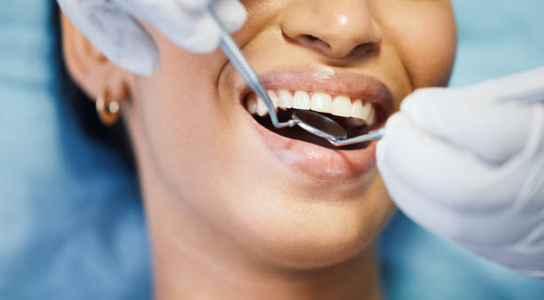 Best Broken Tooth Emergency  in Hillsdale, MI